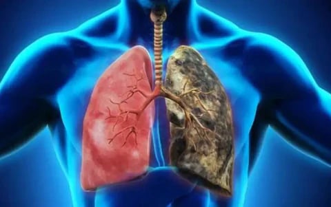 Natravor™ Herbal Mullein Lung Purifier