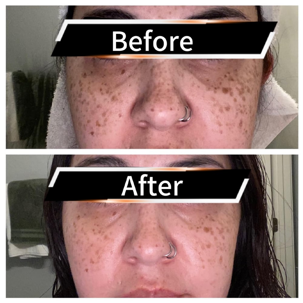 HOYGI Microbiome Balance Repairing Essence image HOYGI Microbiome Balance Repairing Essence