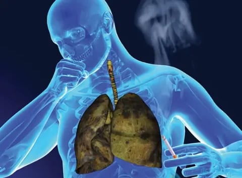 Natravor™ Herbal Mullein Lung Purifier