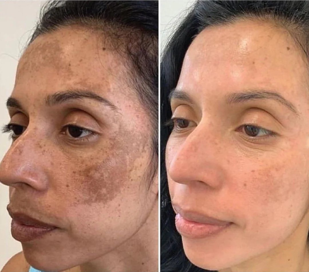 HOYGI Microbiome Balance Repairing Essence image HOYGI Microbiome Balance Repairing Essence