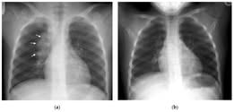 Natravor™ Herbal Mullein Lung Purifier
